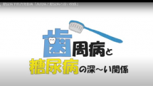 動画サムネイル：糖尿病予防啓発動画「歯周病と糖尿病の深い関係」