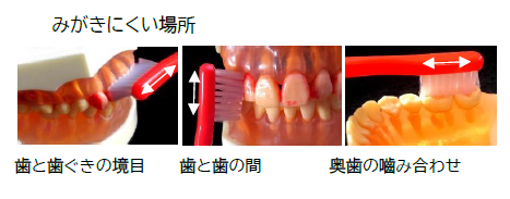 写真：歯磨きのやり方