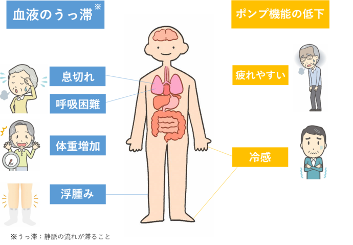 イラスト：心不全症状　血液のうっ滞　ポンプ機能の低下