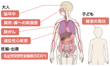 イラスト：受動喫煙による体への影響