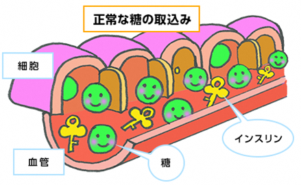 イラスト:正常な糖の取込み