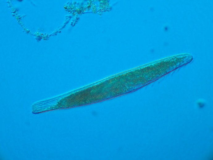 スピロストムム（Spirostomum）